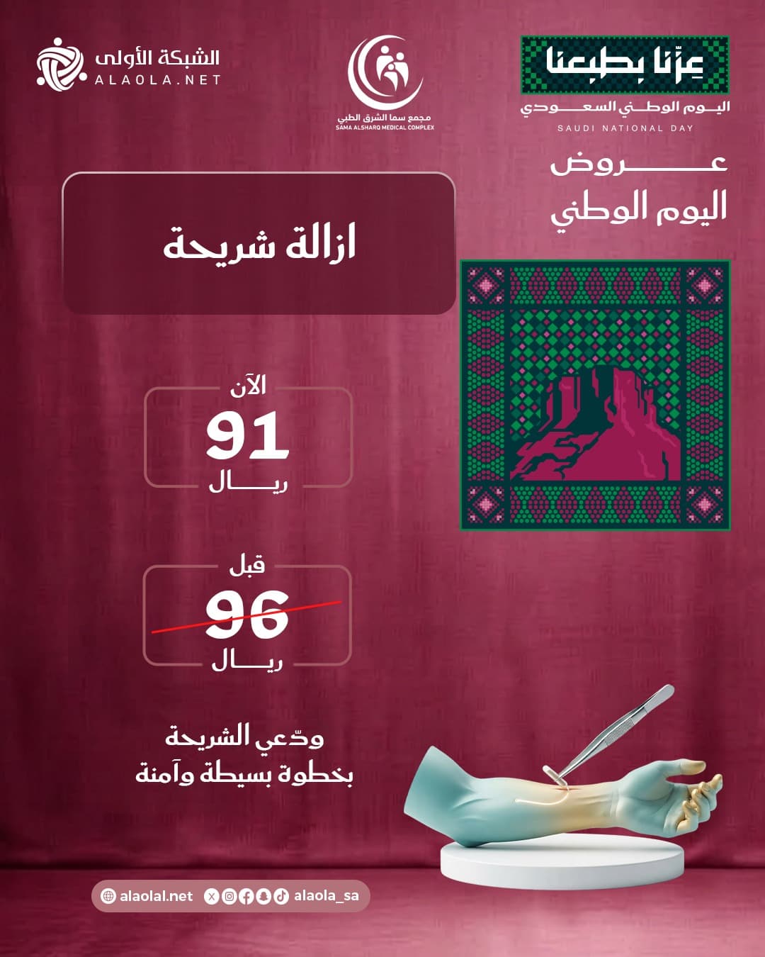 ازالة شريحة