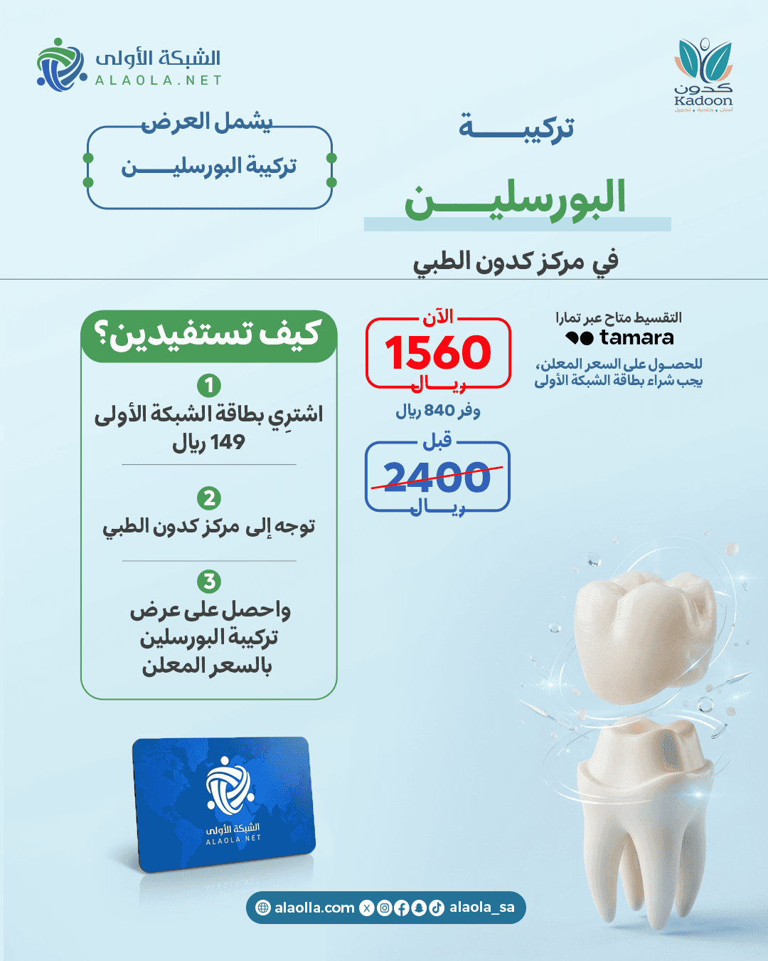 تركيبة البورسلين