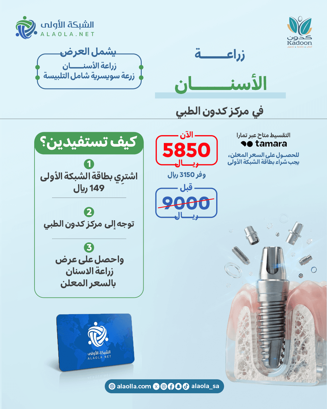 زراعة الاسنان