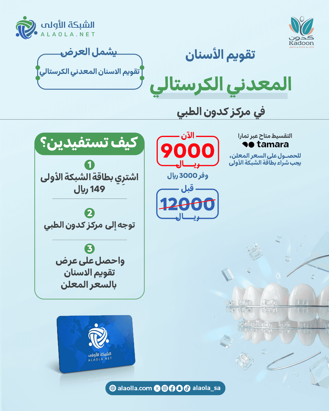 تقويم الاسنان المعدني الكرستالي